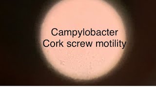 Campylobactercorkscrew motilityCampylobacter under a microscopeCampylobacter jejuni [upl. by Naihs]