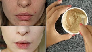 DIY Natural Foundation  Homemade Foundation Recipe with all Natural Ingredients  Rabia Skin Care [upl. by Eibbor]