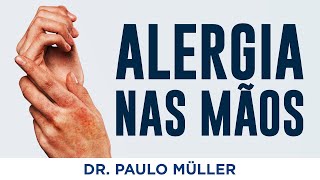 Alergia Nas Mãos – Dr Paulo Müller Dermatologista [upl. by Fezoj]