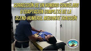 Corrección de un Hombro congelado o coaptación completa de la glenohumeral mediante tracción [upl. by Nnylahs]