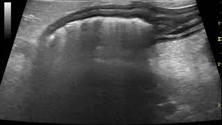 Ultrasonography of acute canine pancreatitis with associated colitis [upl. by Nyltiac658]