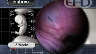 The Human Embryo Eight Weeks After Conception [upl. by Eissehc]