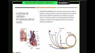 Monitoreo Hemodinámico Avanzado Dr P Pérez [upl. by Hsakiv]