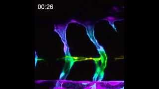 Endothelial cells in pten mutant zebrafish embryos form filopodia over time [upl. by Royden]