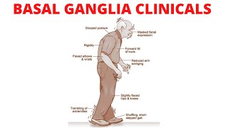 The Basal Ganglia Clinical Anatomy  Parkinson’s Disease  Chorea  Huntington Disease [upl. by Pederson218]