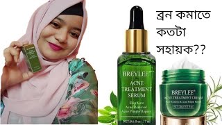 আসলেই কি ব্যবহারে ব্রন যাবে breylee acne treatment sirum and cream breleey cream review [upl. by Tigirb]