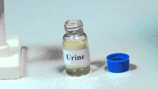 Detection of Bile Salt in Urine  MeitY OLabs [upl. by Akinat]