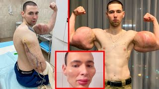 Epic Plastic Surgery Fails [upl. by Nitsraek300]