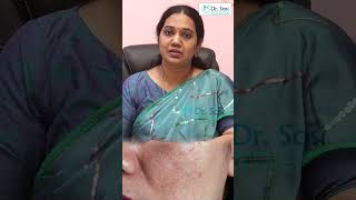 How to choose face wash  best face wash  Skin tips  Dr Sasikala Illaiyaraja  Trichy [upl. by Rinee]