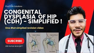 Barlow amp Ortolani test Congenital Hip Dislocation Everything You Need To Know  Dr Ishant Arora [upl. by Eesac868]