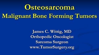 Orthopedic Oncology Course  Malignant Bone Forming Tumors Osteosarcoma  Lecture 4 [upl. by Welles]