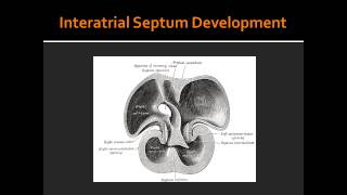 Interatrial Septum Development [upl. by Ettinger]