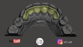 MESHMIXER DENTALTutorial come eseguire uno splintaggio da impronta intraorale Ortho splint retainer [upl. by Denys]