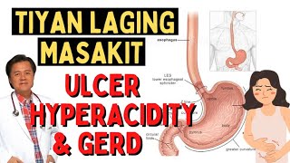 Tiyan Laging Masakit Ulcer Hyperacidity amp GERDBy Doc Willie Ong Internist and Cardiologist1369 [upl. by Athalla165]