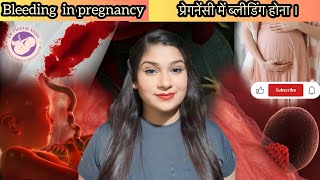 vaginal bleeding or spotting during pregnancy।bleedingduringpregnancy [upl. by Clemens]