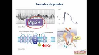 Torsades de pointes pathology video part 4 from USMLE First Aid Step one [upl. by Lolanthe]