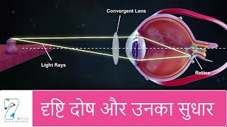 दृष्टि दोष और उनका सुधार  Defects of Vision and their correction  Hindi [upl. by Quincy]