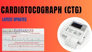 Cardiotocograph CTG Latest Updates [upl. by Floss]