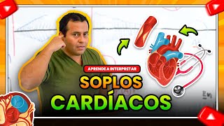 SOPLOS CARDIACOS APRENDE A INTERPRETARLOS ✍🩺 🔊  Semiología Cardiaca [upl. by Notsae]