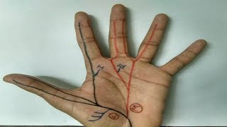 Median Nerve  3  Branches in Hand APB FPB OP Lumbricals 1 and 2 [upl. by Boyt715]