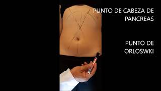 Semiología del Abdomen  Palpación superficial y profunda [upl. by Ahtoelc597]