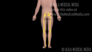 Ciática Animación Alila Medical Media Español [upl. by Airan]