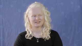 Living with Albinism  Karina [upl. by Alguire]