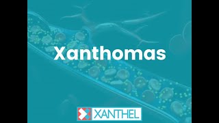 XANTHOMAS  How To Easily Remove Eyelid Xanthomas   Brought To You By XANTHEL® [upl. by Htirehc]