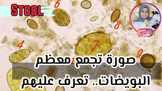 كل انواع الطفيليات في عينات البراز الجزء الاول البويضات ovas in stool samples [upl. by Azile]