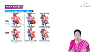 Heart Failure Hindi  Internal Medicine [upl. by Oisinoid901]