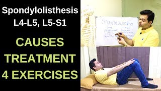 Spondylolisthesis L4L5 L5S1 Spondylolysis Spondylolisthesis Treatment Exercises LOW BACK PAIN [upl. by Farrison]