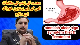 Stomach ulcers stomach ulcer symptoms stomach ulcer treatment in Urdumaide ke Dard ka ilaj [upl. by Caroline250]