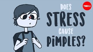 Does stress cause pimples  Claudia Aguirre [upl. by Notxed]