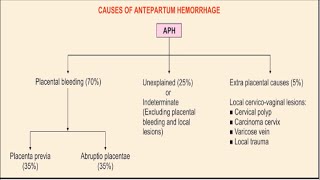 ANTEPARTUM HEMORRHAGE [upl. by Fiona]