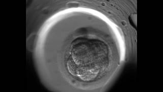 EmbryoScope  New IVF Technology [upl. by Trilby]