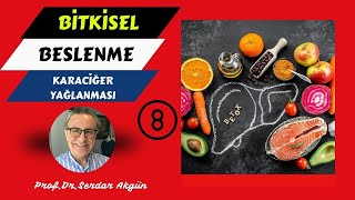 8KARACİĞER YAĞLANMASI Damar Tıkanıklığı Bitkisel Beslenme Sağlık ProfDrSerdar Akgün [upl. by Ailatan]