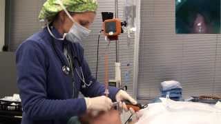 Video laryngoscope Tracheal intubation with Bougie Port [upl. by Shaylynn208]