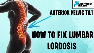 How To Fix Lumbar Lordosis and Anterior Pelvic Tilts  Full Exercise and Stretch Plan [upl. by Giselle316]