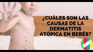 ¿Cuáles son las causas de la Dermatitis Atópica en bebés [upl. by Irneh613]