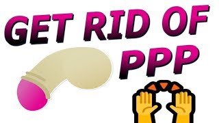 How to remove pearly penile papules PPP [upl. by Eniahs976]