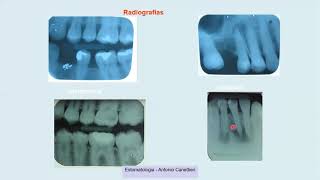 ESTOMATOLOGIA Exames complementares [upl. by Ryon]