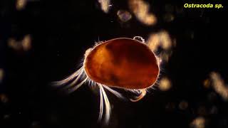 Ostracoda sp  Protozoans and other small critters [upl. by Ellimahs883]