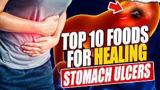 Top 10 Foods to Heal Your Stomach Ulcer Naturally [upl. by Anelec]