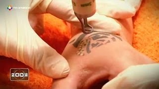 Cómo borrar tatuajes con láser [upl. by Yffat403]