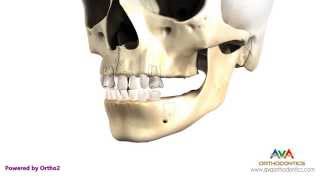 Teeth Eruption Pattern from Primary to Permanent Dentition [upl. by Inasah]