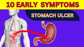 Top 10 Warning Signs of a Stomach Ulcer  Dont Ignore These GASTRIC ULCER SYMPTOMS [upl. by Florenza526]