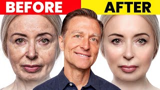 The Ultimate Face Transformation–Dr Bergs Best Remedy for Dry Skin and Wrinkles [upl. by Pump]