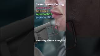 Never Hide Again Co2 Laser Acne Scar Remedy [upl. by Mariann]