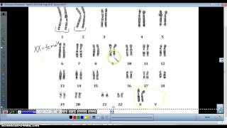 Karyotype analysis [upl. by Engelbert399]