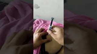 injection video ll injection viral video ll intramuscular injection procedure ll intramuscular llll [upl. by Ilyse]